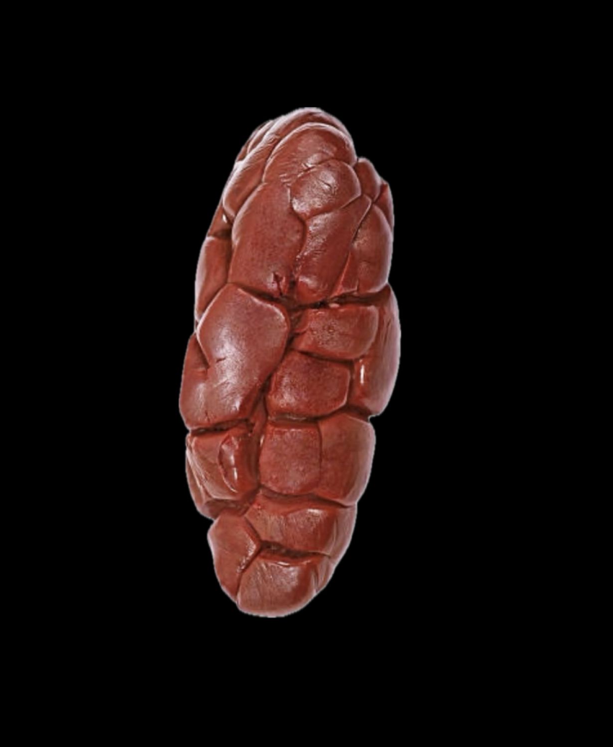 Kidney